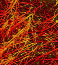 brain cells neurons human being human neurons magnification