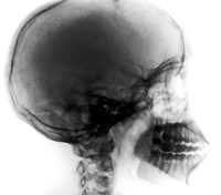This is your skull on X-Rays